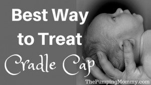 how-to-treat-cradle-cap