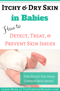 itchy and dry skin in babies