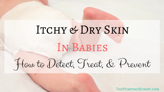Itchy & Dry Skin in Babies: How to Detect, Treat and Prevent