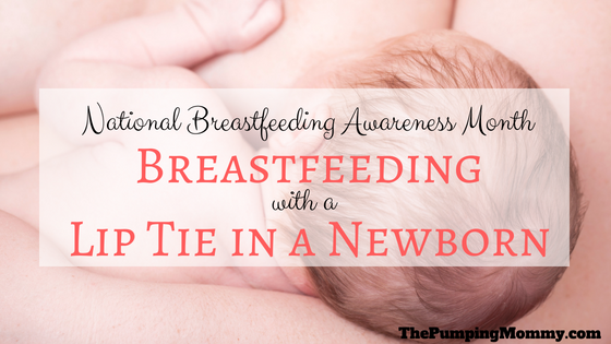 breastfeeding and lip tie in newborn